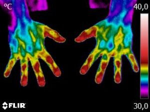 termografia das mãos