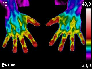termografia médica Archives | Dra. Claudia Sá | Dermatologista