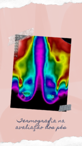 termografia na análise dos pés